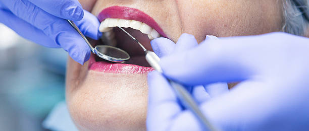 Best Emergency Dental Surgery in North Wilkesboro, NC